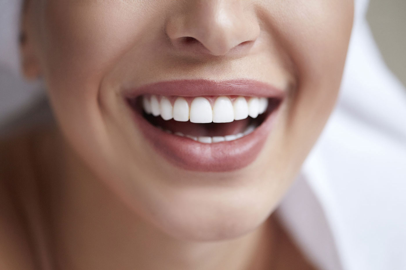 white-smile